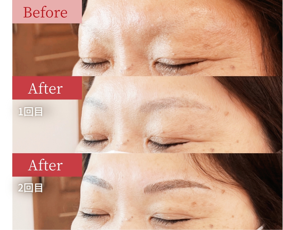 症例01 Before / After