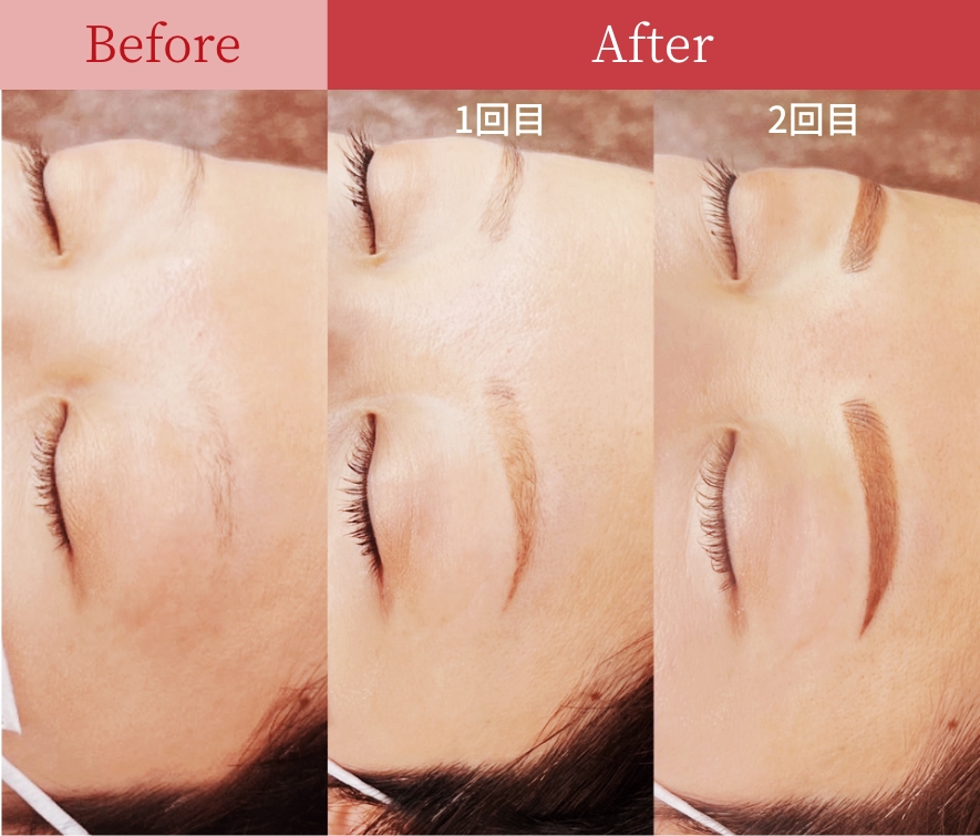 症例02 Before / After