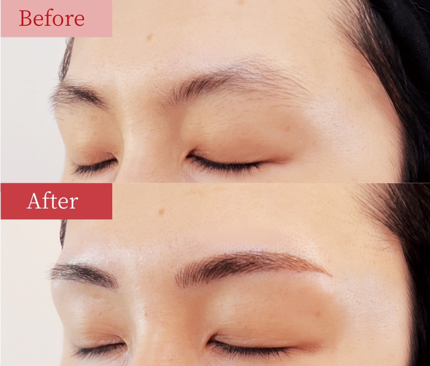 症例03 Before / After